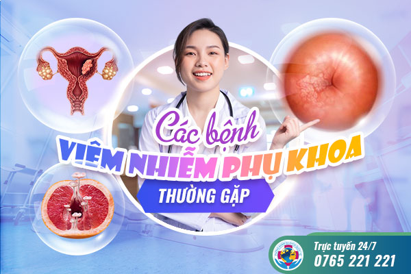 Các bệnh viêm nhiễm phụ khoa thường gặp – chị em không nên chủ quan