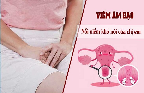 [Cảnh báo] 7+ Nguyên nhân viêm âm đạo nhiều chị em chủ quan