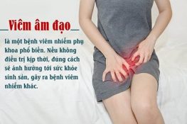 Viêm âm đạo là gì – Dấu hiệu, nguyên nhân và cách điều trị