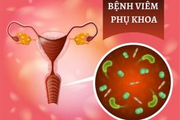 Viêm phụ khoa là gì – Dấu hiệu, nguyên nhân & cách điều trị