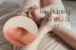 Ra khí hư nâu là bệnh gì? Cách khắc phục hiệu quả?