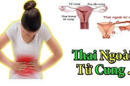 Mang thai ngoài tử cung và những điều chị em cần biết