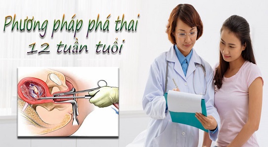 Phá thai 12 tuần có được không? Phá bằng phương pháp gì?